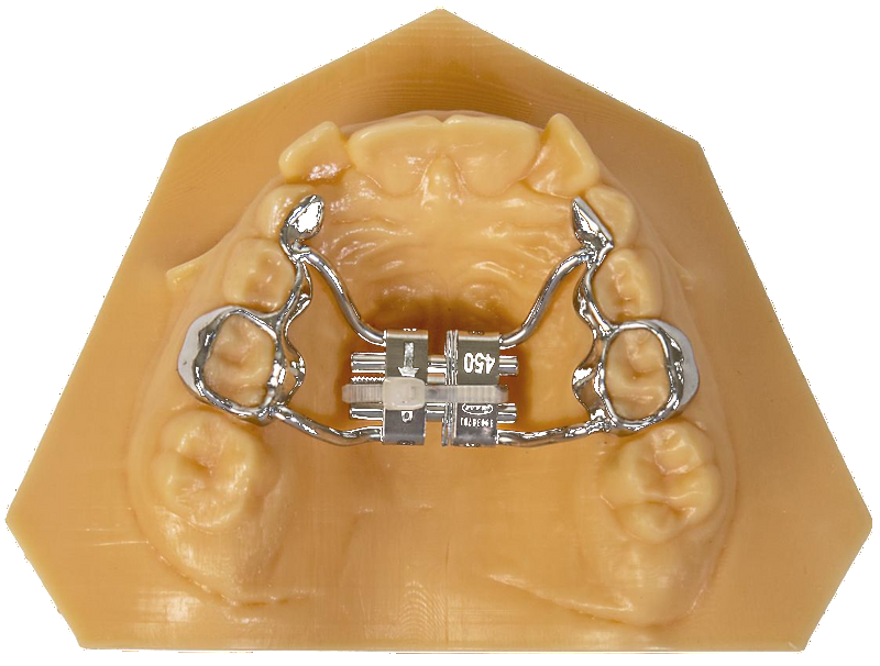 Espansore scheletrico su modello dentale