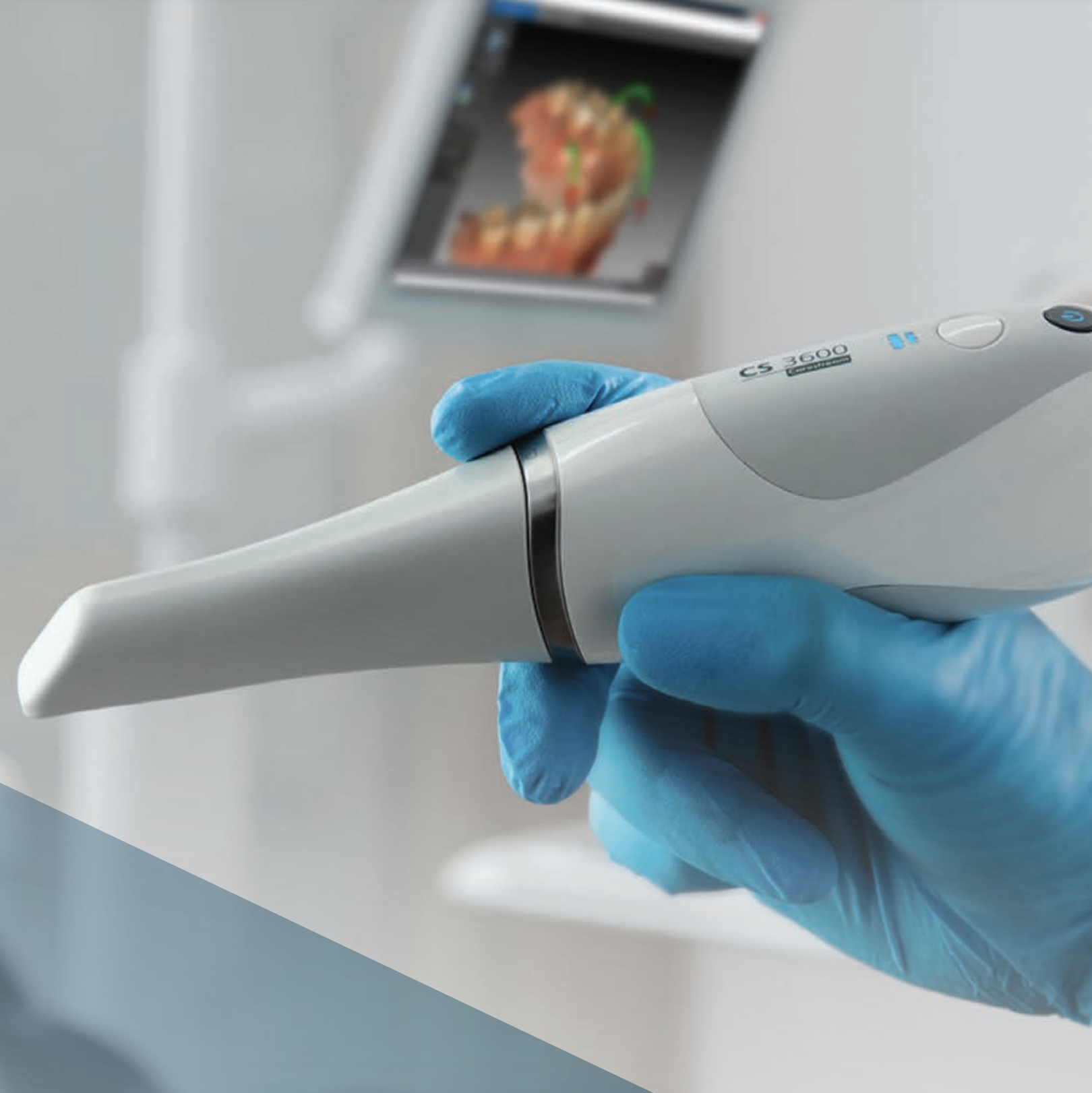 Scanner intraorale
