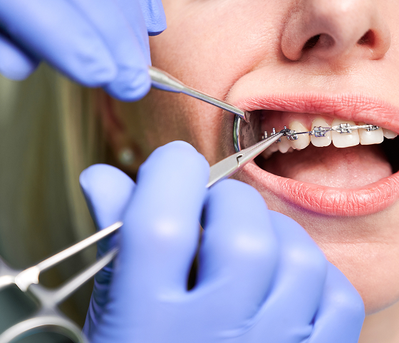 Orthodontist during treatment